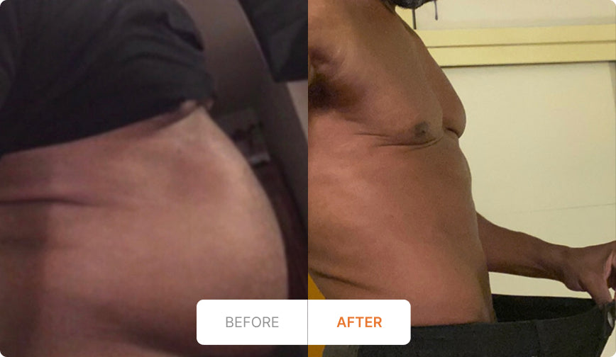 Before and After