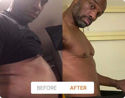 Before and After