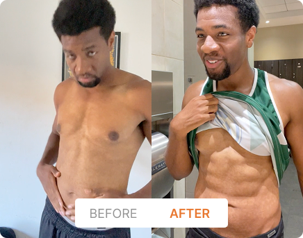 Before and After